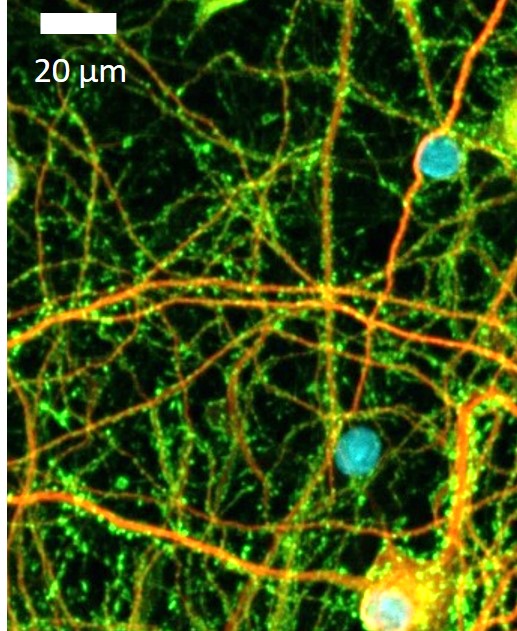 72017-ALZ-Fig2