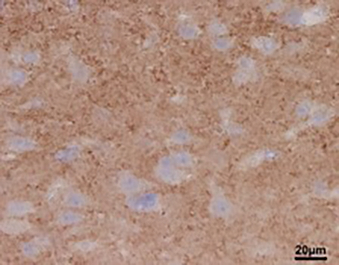 72017-ALZ-Fig4