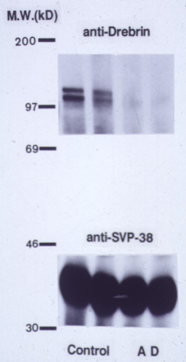 /72017-ALZ-Fig6