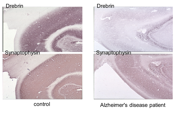 ALZ-160838-ALZ-Fig5
