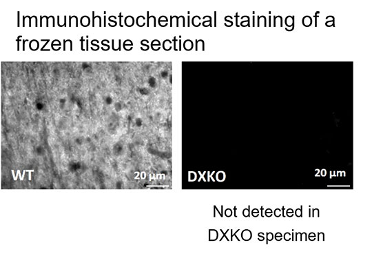 ALZ-160838-IHC-Diagnocine