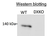 ALZ-160838-WB-Diagnocine