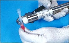 Step 2 of Cell Preservation: sealing the liquid inlet.