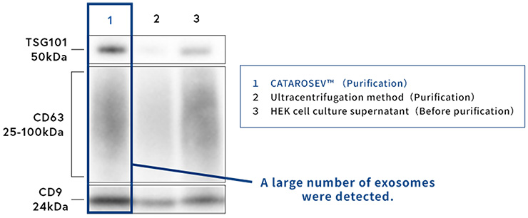 Comparison-of-recovered-exosome-amounts-by-Western-blotting-Diagnocine.jpg