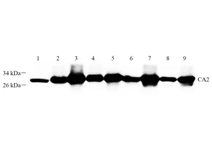 GB112426-2.png
