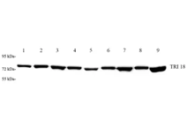 GB112569-3.png