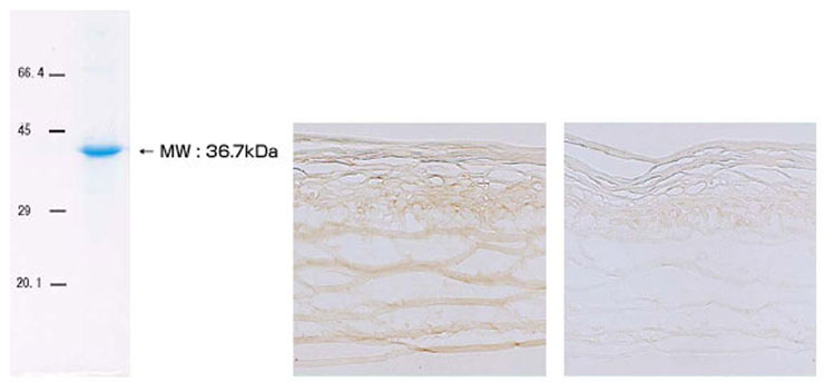 Hyaluronan-Binding-Protein, Recombinant, HABP by Diagnocine