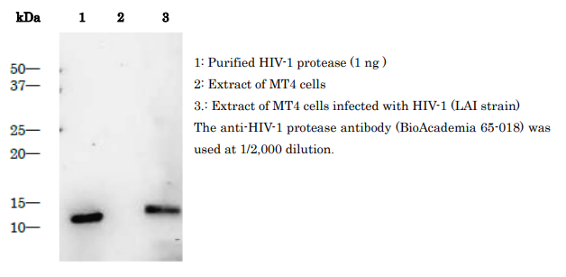 Fig.3 Purified HIV-1 protease as control antigen for Western blotting analysis with anti-HIV-1 protease antibody.