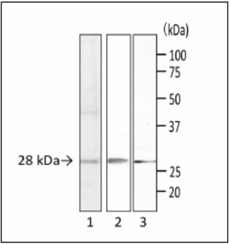 Fig.1. Detection of S. aureus enterotoxins by Western blotting with monoclonal antibody (MAb sa-01). 