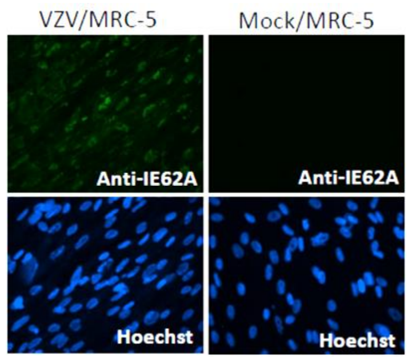 Fig.2. Immunofluorescence staining of VZV IE62 protein in VZV-infected MRC-5 cells by using antiVZV IE62 antibody (clone 62A)