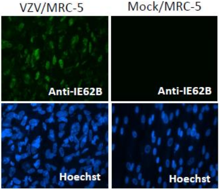 Fig.2. Immunofluorescence staining of VZV IE62 protein in VZV-infected MRC-5 cells