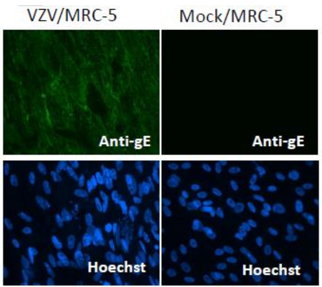 Fig.2. Immunofluorescence staining of VZV gE protein in VZV-infected MRC-5 cells by using antiVZV gE antibody (clone #9)