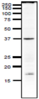 Fig.2 Detection of endogenous Rad51 in crude extract of Xenopus