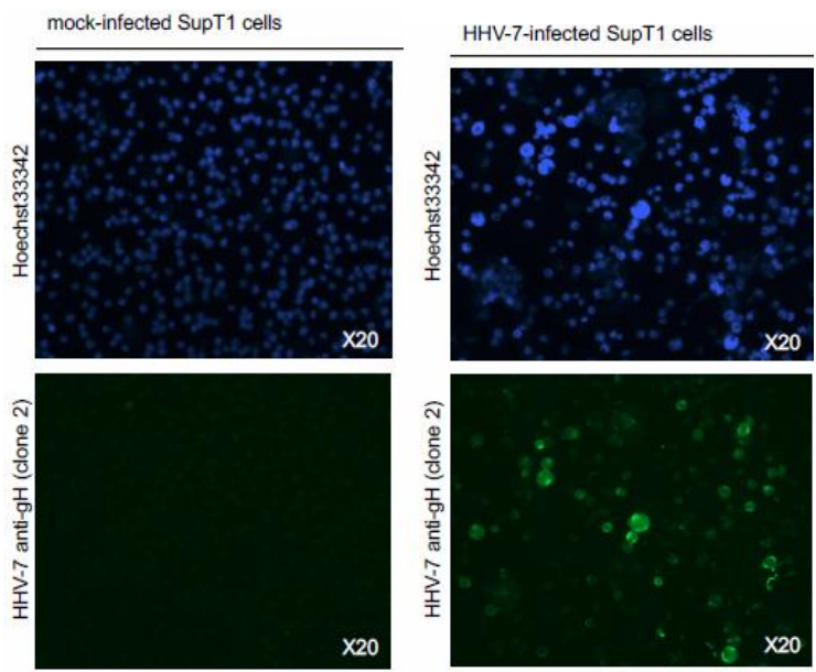 Fig.3. Immunofluorescence staining of gH protein in SupT1 cells infected with HHV-7