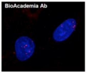 Fig.3 Detection of Rad51 foci: formation induced by DNA damage