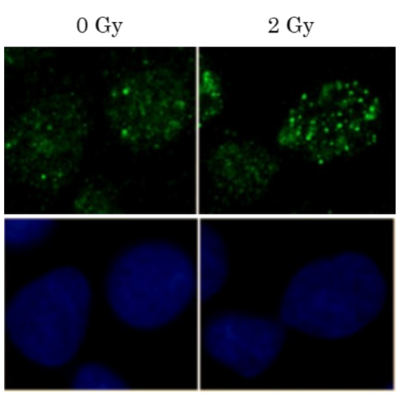 Fig.4 Induction of Rad51 foci formation by X-ray Irradiation