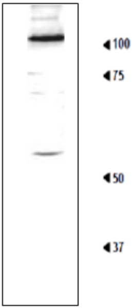 Fig.1 Detection of Rpn1 in the crude extract of S. cerevisiae by Western blotting using this antibody. 