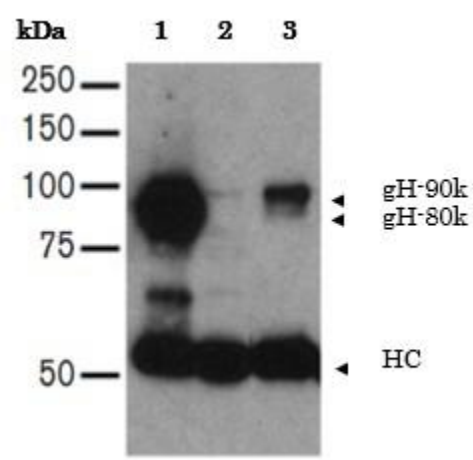Fig.1. Immunoprecipitation of HHV7 gH in the lysate of HHV7 infected-SupT-1 cells