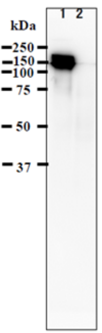 Fig.1. Identification of IE62 protein in VZV-infected cells by western blotting using anti-VZV IE62 antibody (clone 62A)?