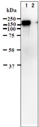 Fig.1. Identification of IE62 protein in VZV-infected cells by western blotting using anti-VZV IE62 antibody (clone 62B).