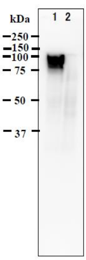 Fig.1. Identification of gE protein in VZV-infected cells by western blotting using anti-VZV gE antibody (clone #9)