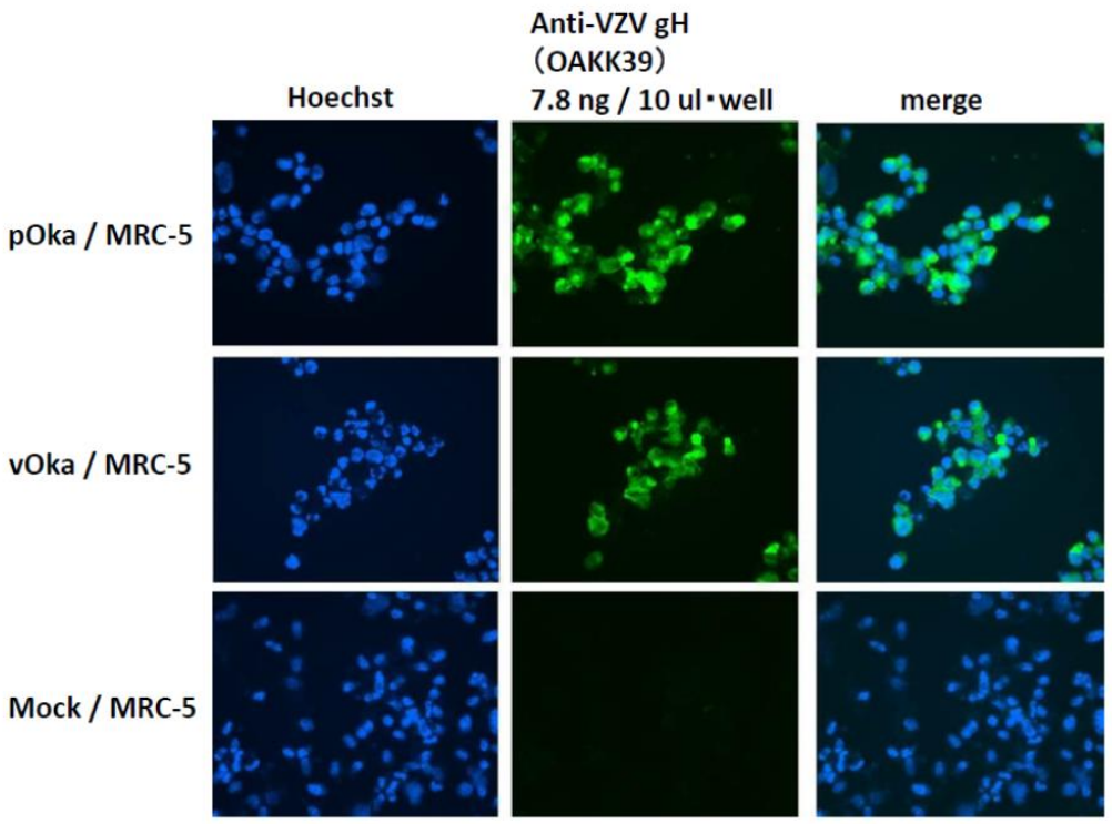 Fig.1? Immunofluorescence staining of VZV glycoprotein H in VZV-infected MRC-5 cells by using anti-VZV gH antibody (clone OAKK39)