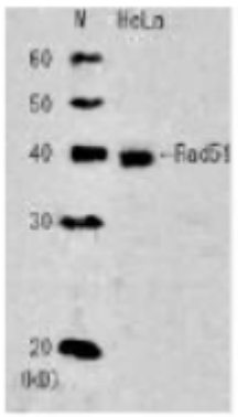 Fig.1 Detection of endogenous Rad51 in whole cell extraxt of HeLa cells