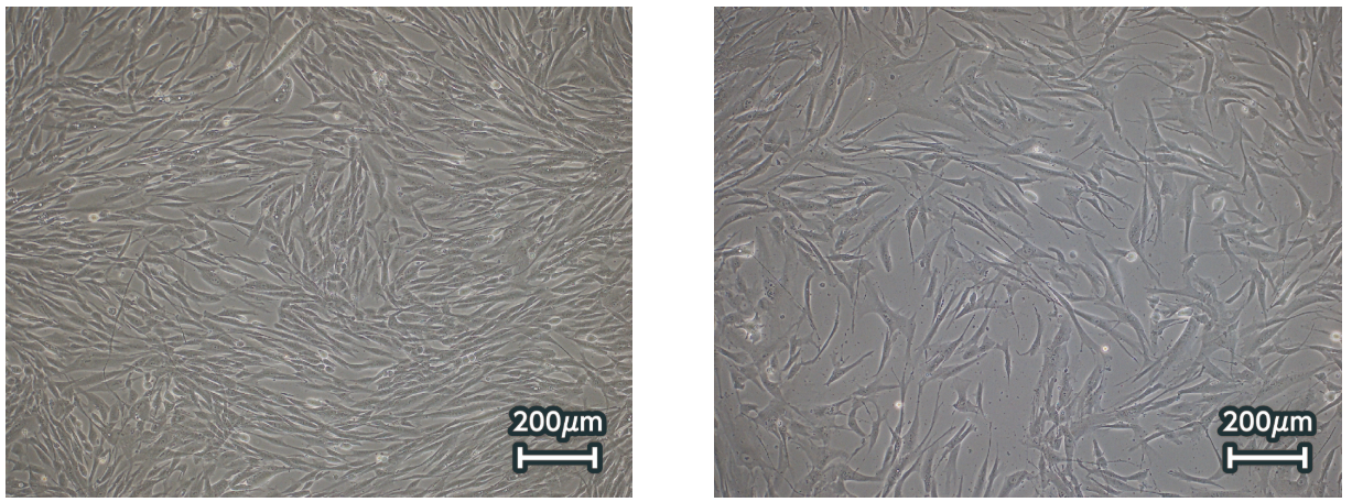Normal human ADSCs cultured with Xyltech™ Growth MSC Xeno-Free and Xyltech™ MSC-01 Xeno-Free
