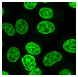 NucleoSeeing_Diagnocine-09282023