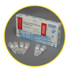 ReverTra Ace qPCR RT Master Mix with gDNA Remover