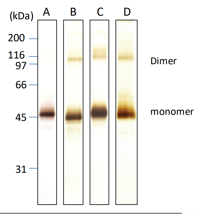 HBsAg, L-protein of genotype A to D were subjected for SDS-PAGE (Silver staining) at 100ng