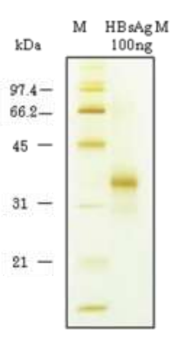HBsAg, M-protein subjected for SDS-PAGE (Silver staining) at 100ng.