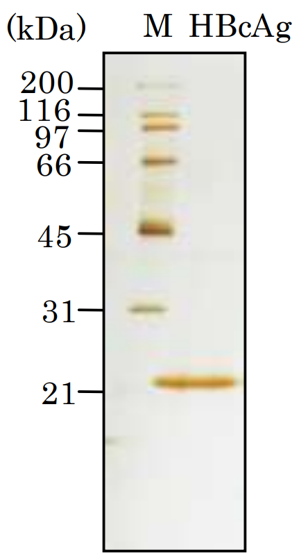 HbcAg of 100ng subjected to SDS-PAGE (silver staining). 