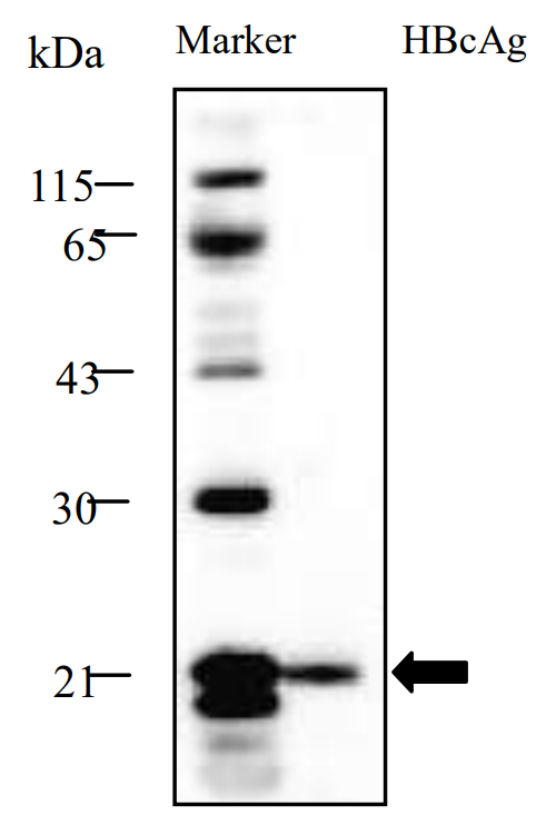 Western blot for HBcAg sample.