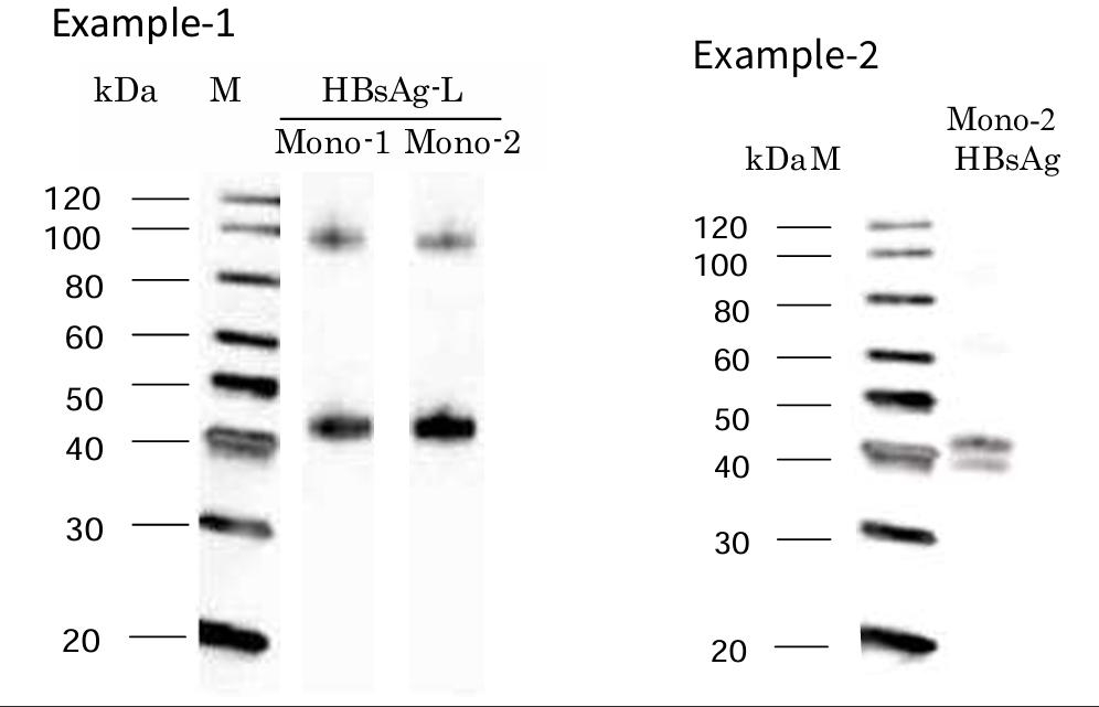 Western blot examples of HBsAg-L protein and purified HBsAg from human serum