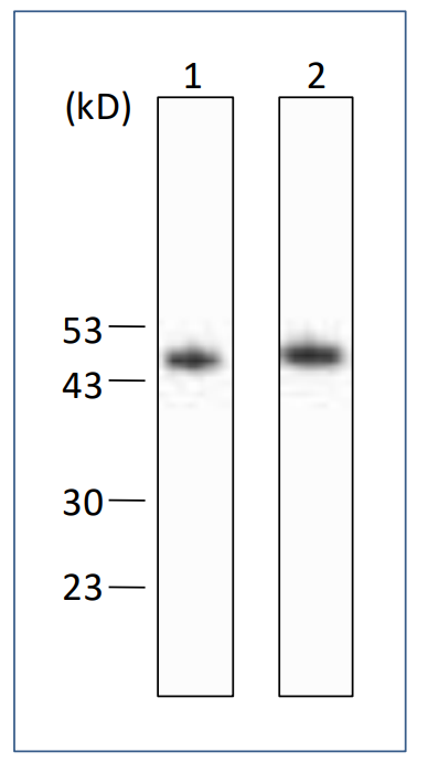 Western blot analysis results of using HBsAg-L protein as a sample on FNK-BCL-ABM2-01 and FNK-BCL-ABM2-02.