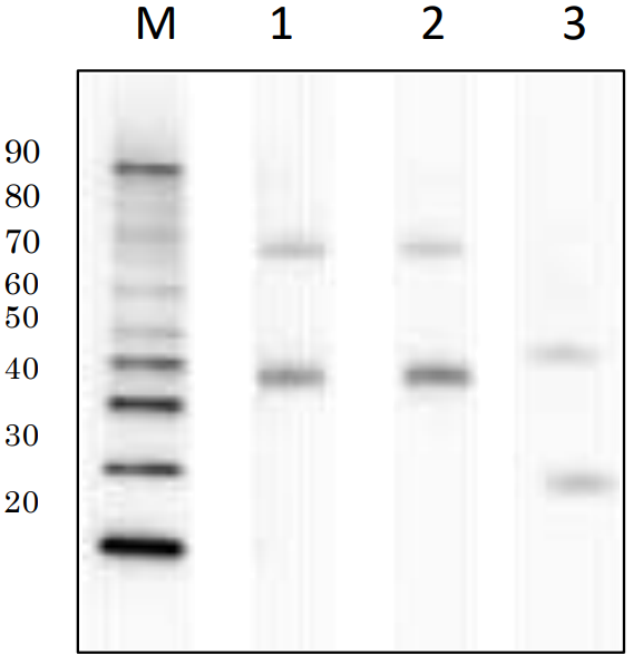 Western blot example for anti-Pre-S1 vs anti-Pre-S2 and and anti-S