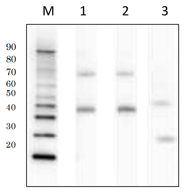 Western blot of FNK-BCL-ABP2-01.