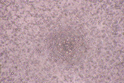 filtration_02-1.jpg