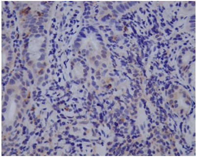 Human Esophagus paraffin section