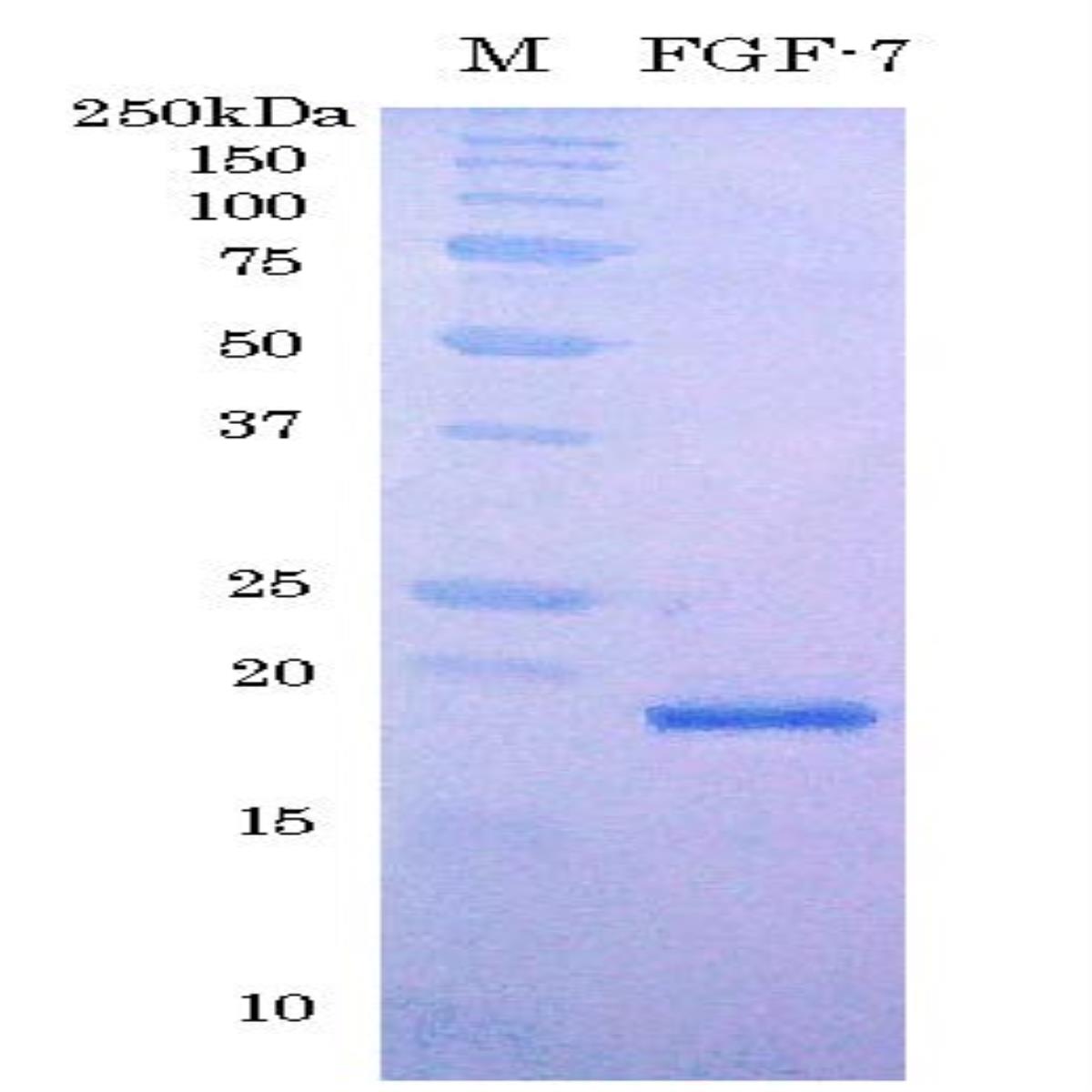 /Content/Upload/Product/03-005_fig1_1200.jpg
