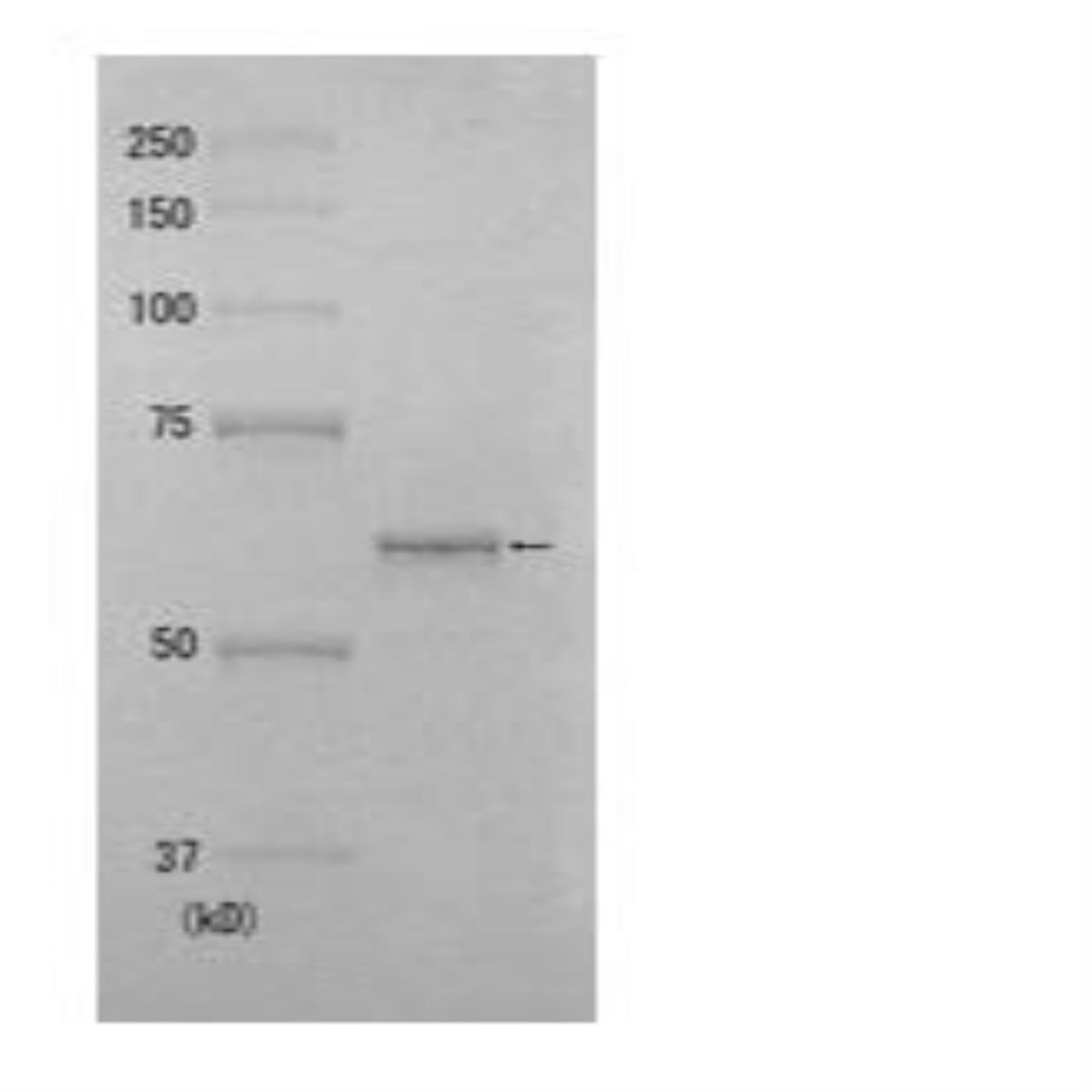/Content/Upload/Product/10-105_fig2_1200.jpg