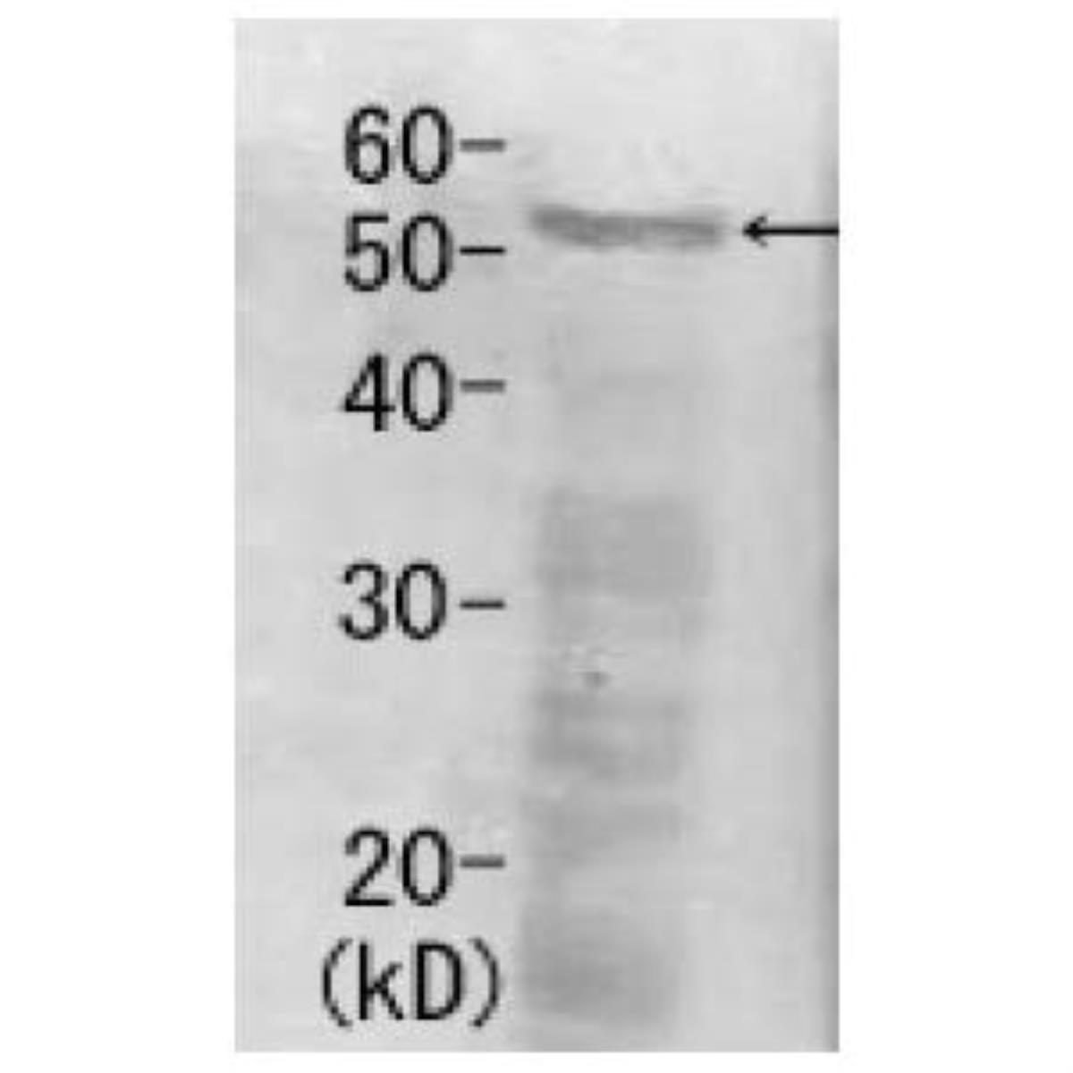 /Content/Upload/Product/62-203_fig1_1200.jpg