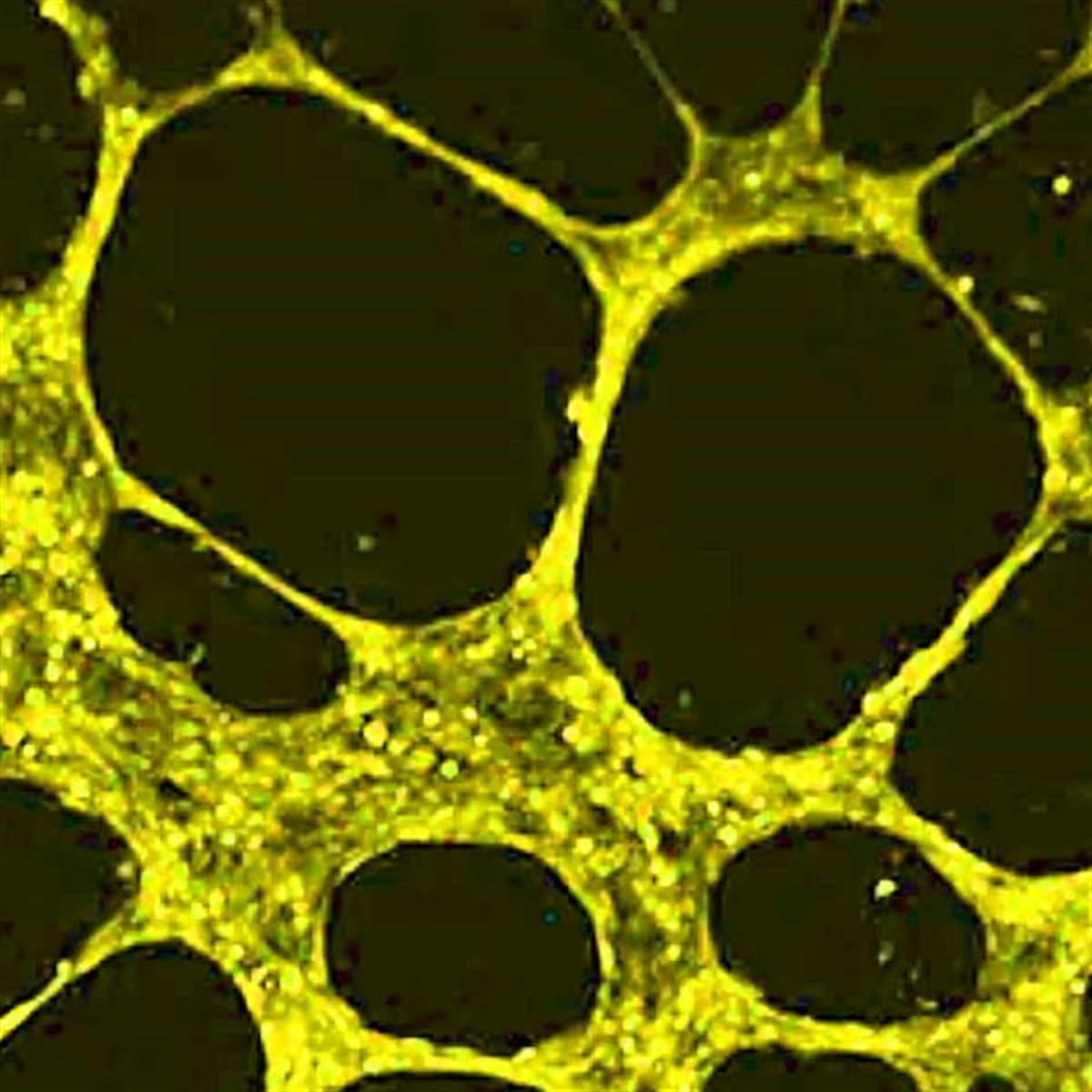 /Content/Upload/Product/AngioFlamma552_diagnocine_1200.jpg