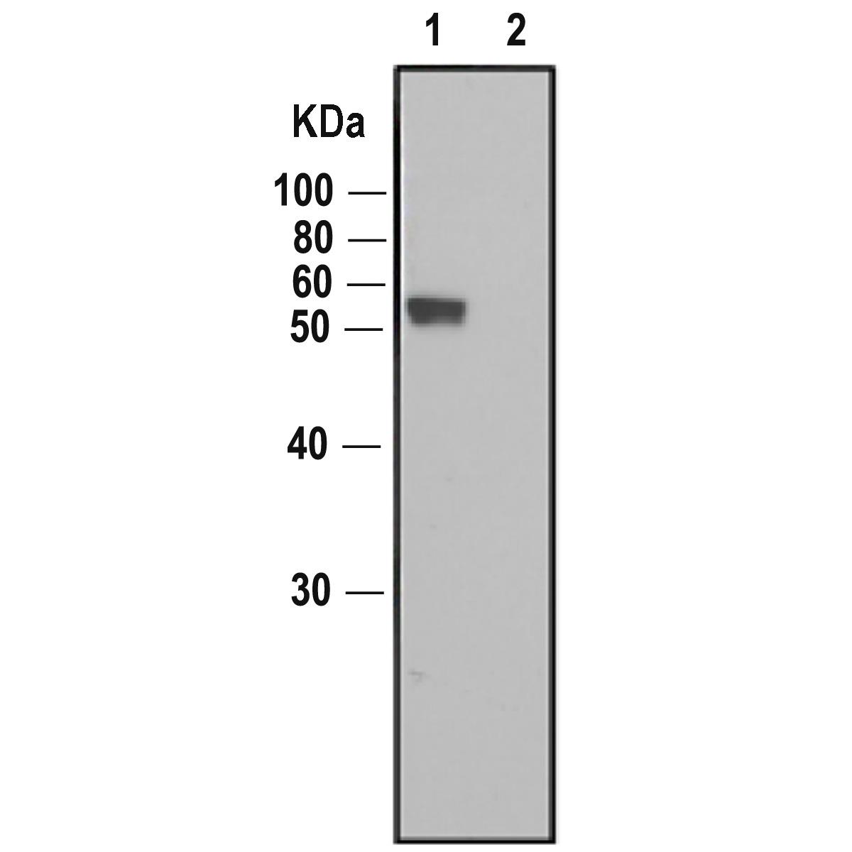 /Content/Upload/Product/Anti-IZUMO1-antibody_rat-monoclonal_125_73-045_fig1_w1200_Diagnocine_1200.jpg