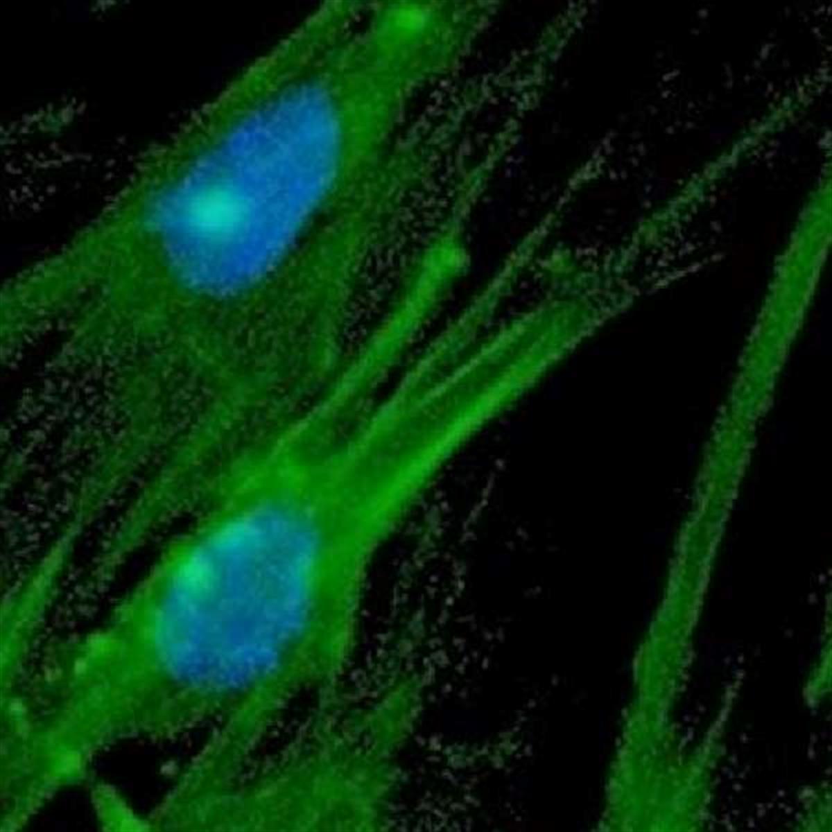 /Content/Upload/Product/BiotinFlamma496_1200.jpg