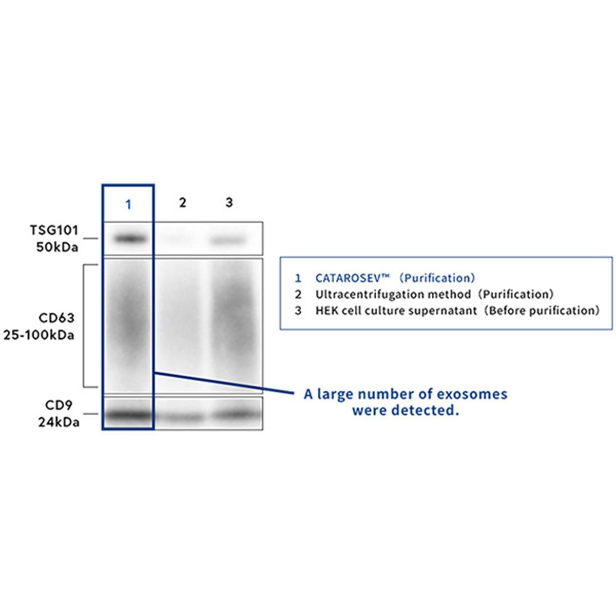 /Content/Upload/Product/Buffer-Set-for-CATAROSEV-TYB-CTS-011-Diagnocine_1200.jpg