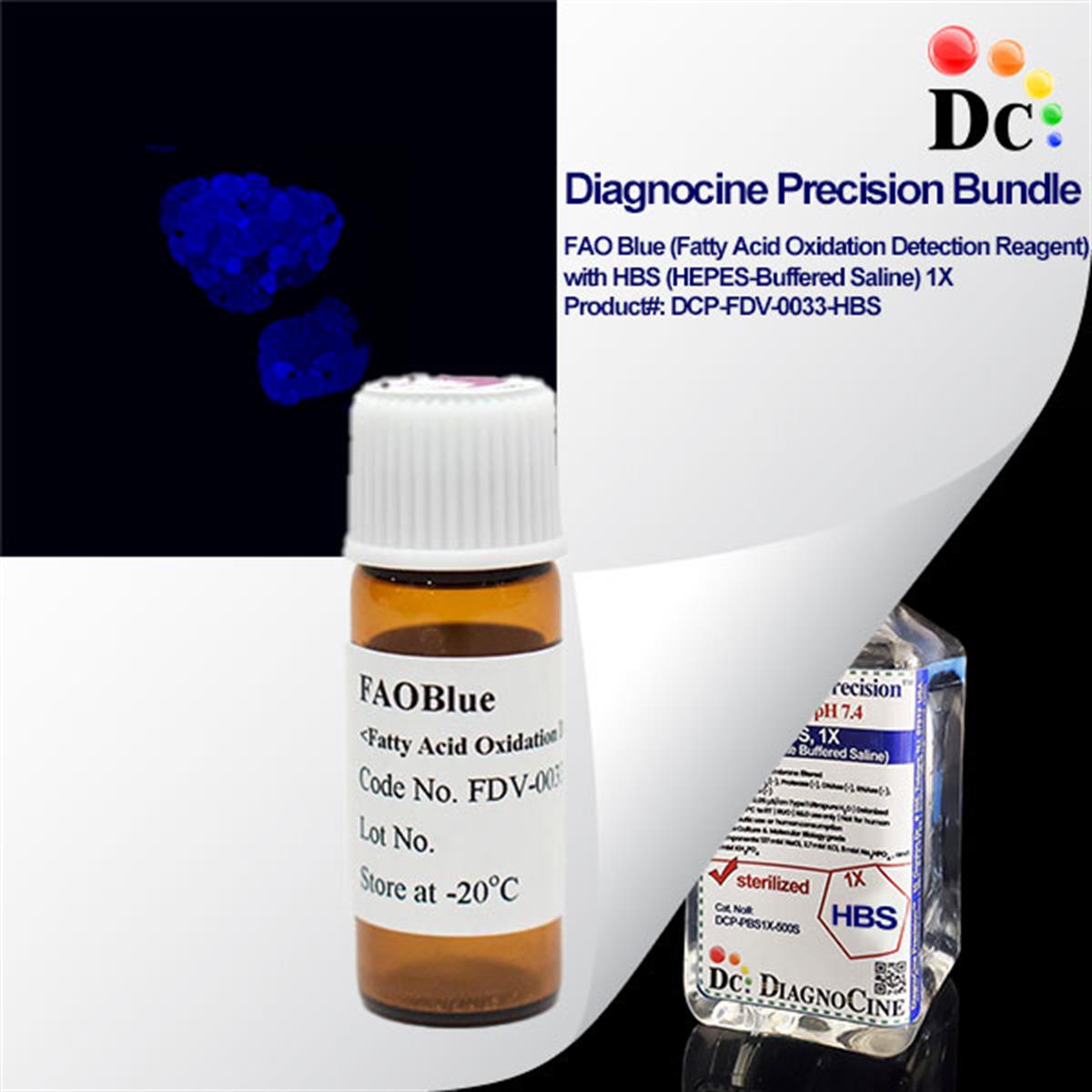 /Content/Upload/Product/DCP-FDV-0033-HBS_w600_Diagnocine_1200.jpg