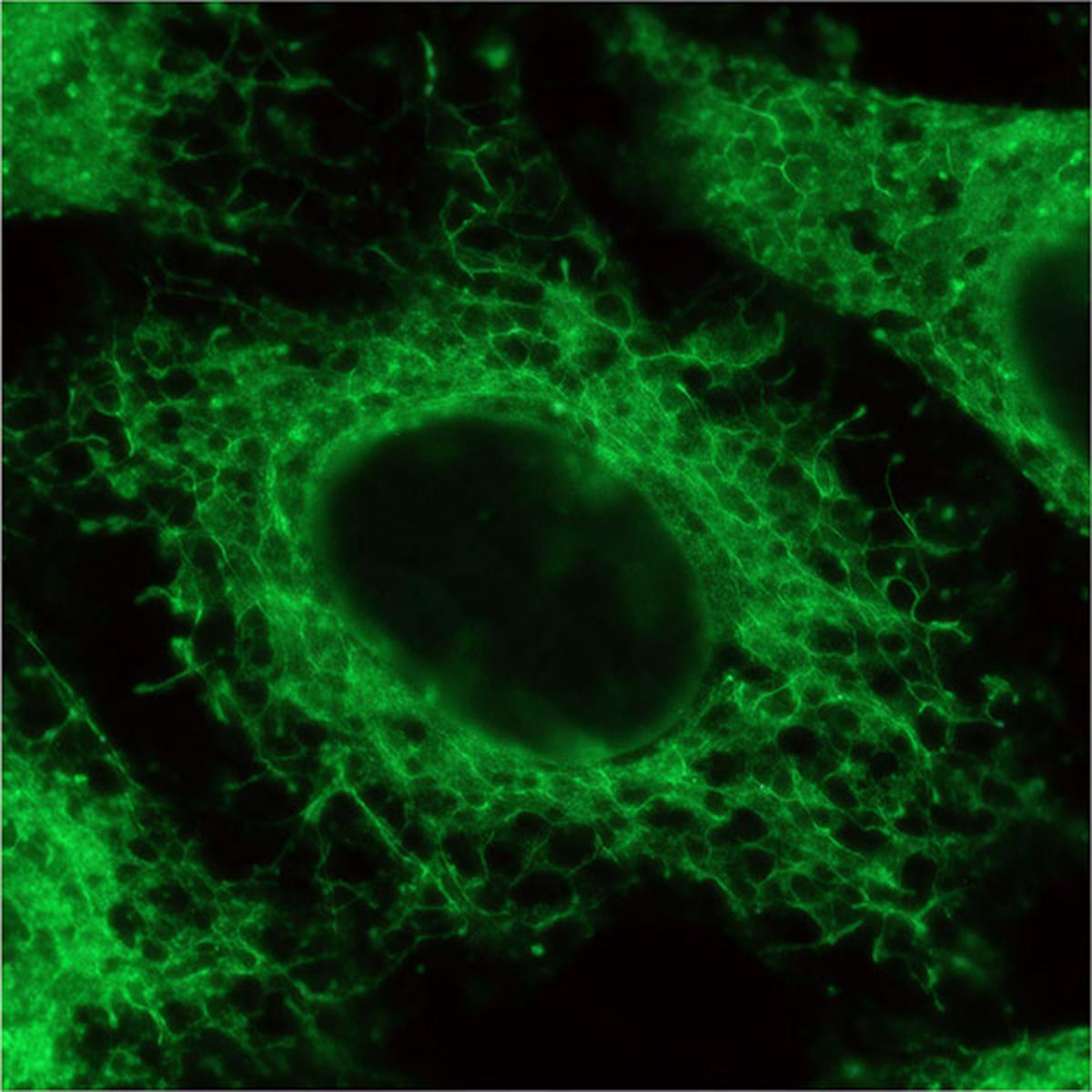 /Content/Upload/Product/ERseeing_Endoplasmic-Reticulum-Green_FNK-FDV-0038_Diagnocine_1200.jpg