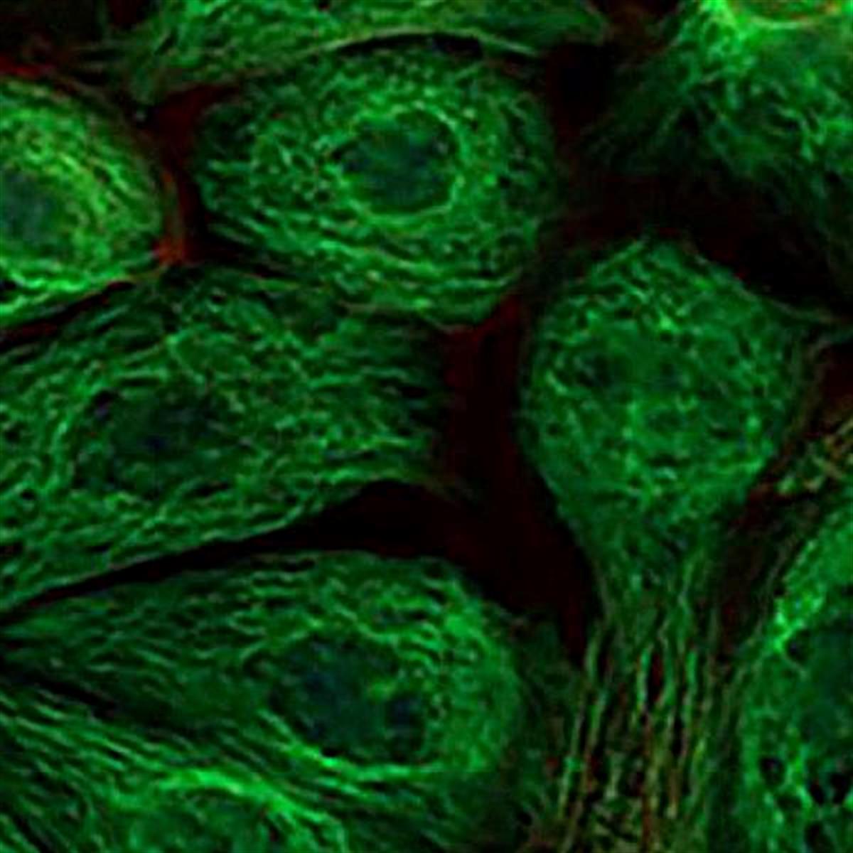 /Content/Upload/Product/FAMNHSester_diagnocine_1200.jpg